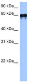 Transglutaminase-3-like antibody, TA331020, Origene, Western Blot image 