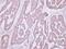 Occludin antibody, PA5-30230, Invitrogen Antibodies, Immunohistochemistry paraffin image 