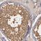 Centrosomal Protein 55 antibody, FNab01605, FineTest, Immunohistochemistry frozen image 