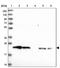 ATP Synthase Peripheral Stalk Subunit OSCP antibody, PA5-59548, Invitrogen Antibodies, Western Blot image 