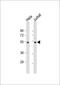 Protein Tyrosine Phosphatase Non-Receptor Type 1 antibody, 63-459, ProSci, Western Blot image 