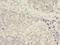 Adenosine Deaminase antibody, LS-C369169, Lifespan Biosciences, Immunohistochemistry frozen image 