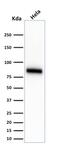 CD44 antibody, GTX34514, GeneTex, Western Blot image 