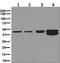 Hydroxymethylbilane Synthase antibody, ab129092, Abcam, Western Blot image 
