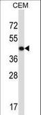 ACTH antibody, LS-B11114, Lifespan Biosciences, Western Blot image 