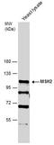 MutS Homolog 2 antibody, PA5-78685, Invitrogen Antibodies, Western Blot image 