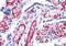 FcRII antibody, NB100-1532, Novus Biologicals, Immunohistochemistry paraffin image 