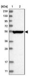 TSPY Like 6 antibody, NBP1-85917, Novus Biologicals, Western Blot image 