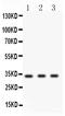 Cyclin D1 antibody, PB9370, Boster Biological Technology, Western Blot image 