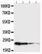 Growth Hormone 1 antibody, RP1024, Boster Biological Technology, Western Blot image 