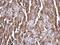 Glutathione S-Transferase Mu 1 antibody, NBP1-33523, Novus Biologicals, Immunohistochemistry paraffin image 