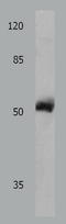 Matrix Metallopeptidase 8 antibody, TA321482, Origene, Western Blot image 