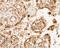 Proteasome 20S alpha 3 antibody, NBP2-80474, Novus Biologicals, Immunohistochemistry paraffin image 