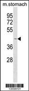 Collagen Like Tail Subunit Of Asymmetric Acetylcholinesterase antibody, 60-634, ProSci, Western Blot image 