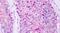 G Protein-Coupled Receptor Class C Group 5 Member A antibody, PA5-33797, Invitrogen Antibodies, Immunohistochemistry paraffin image 