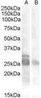 Transient receptor potential cation channel subfamily V member 5 antibody, 46-533, ProSci, Western Blot image 
