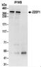 Zinc Finger ZZ-Type And EF-Hand Domain Containing 1 antibody, NBP2-32120, Novus Biologicals, Immunoprecipitation image 