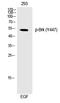 Protein Tyrosine Kinase 6 antibody, P01881, Boster Biological Technology, Western Blot image 