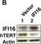 Telomerase Reverse Transcriptase antibody, NB100-317, Novus Biologicals, Western Blot image 