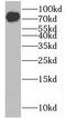 Glucuronidase Beta antibody, FNab03733, FineTest, Western Blot image 