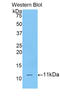 CD3d Molecule antibody, LS-C293356, Lifespan Biosciences, Western Blot image 