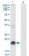 Phosphatidylinositol Glycan Anchor Biosynthesis Class H antibody, MA5-19601, Invitrogen Antibodies, Western Blot image 