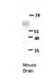 ETS Transcription Factor ERG antibody, 27-118, ProSci, Enzyme Linked Immunosorbent Assay image 