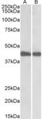 Isocitrate Dehydrogenase (NADP(+)) 1, Cytosolic antibody, STJ72433, St John