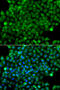 Complement Factor H Related 3 antibody, STJ110086, St John