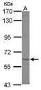 Asparagine Synthetase (Glutamine-Hydrolyzing) antibody, PA5-34693, Invitrogen Antibodies, Western Blot image 