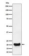 Dynactin Subunit 5 antibody, M12563, Boster Biological Technology, Western Blot image 