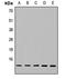 NADH:Ubiquinone Oxidoreductase Subunit A5 antibody, LS-C667925, Lifespan Biosciences, Western Blot image 