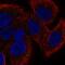Interleukin 1 Receptor Like 1 antibody, HPA007917, Atlas Antibodies, Immunocytochemistry image 