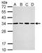 Proteasome Activator Subunit 3 antibody, LS-C185832, Lifespan Biosciences, Western Blot image 