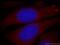 Zinc Finger FYVE-Type Containing 9 antibody, 14821-1-AP, Proteintech Group, Immunofluorescence image 
