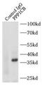 Protein Phosphatase 1 Catalytic Subunit Beta antibody, FNab06695, FineTest, Immunoprecipitation image 