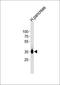 Progesterone Immunomodulatory Binding Factor 1 antibody, orb1505, Biorbyt, Western Blot image 