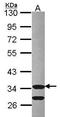 Cyclin Dependent Kinase 3 antibody, GTX105047, GeneTex, Western Blot image 