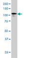 Ubiquitin Specific Peptidase 33 antibody, H00023032-M01, Novus Biologicals, Western Blot image 