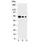 Interleukin 23 Subunit Alpha antibody, R30542, NSJ Bioreagents, Western Blot image 