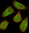 Collagen Type IV Alpha 1 Chain antibody, 62-860, ProSci, Immunofluorescence image 