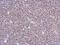 Zinc Finger BED-Type Containing 8 antibody, GTX123000, GeneTex, Immunohistochemistry paraffin image 