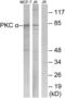 Protein Kinase C Alpha antibody, abx012800, Abbexa, Western Blot image 