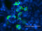 ALK Receptor Tyrosine Kinase antibody, M00301-2, Boster Biological Technology, Immunofluorescence image 
