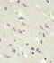 GA antibody, MBS9205614, MyBioSource, Immunohistochemistry frozen image 