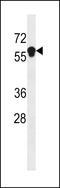 Ankyrin Repeat And Death Domain Containing 1B antibody, LS-C203719, Lifespan Biosciences, Western Blot image 