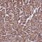 Zinc Finger Protein 749 antibody, PA5-59859, Invitrogen Antibodies, Immunohistochemistry paraffin image 