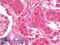 Arylsulfatase B antibody, LS-B10126, Lifespan Biosciences, Immunohistochemistry paraffin image 