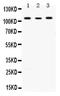 Actinin Alpha 4 antibody, LS-C662443, Lifespan Biosciences, Western Blot image 