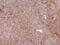 Phosphoglycerate Dehydrogenase antibody, PA5-27578, Invitrogen Antibodies, Immunohistochemistry frozen image 